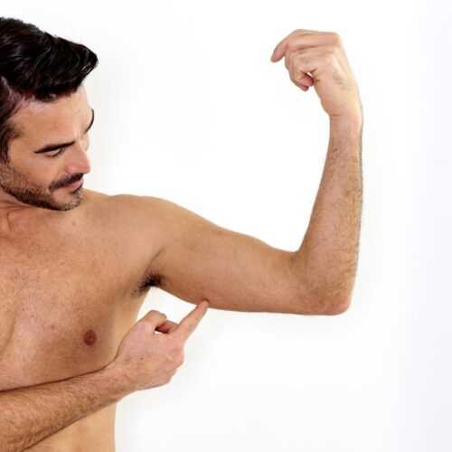 EA Clinic Harley Street Man poses for Arm Lifts and Bum Lifts Treatment