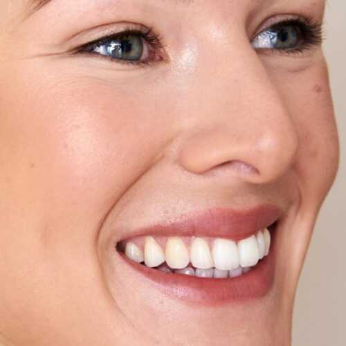 EA Clinic Harley Street offers Nose Dermal Filler