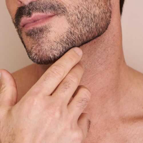 Dermal Fillers for Neck at EA Clinic with Dr Anthony