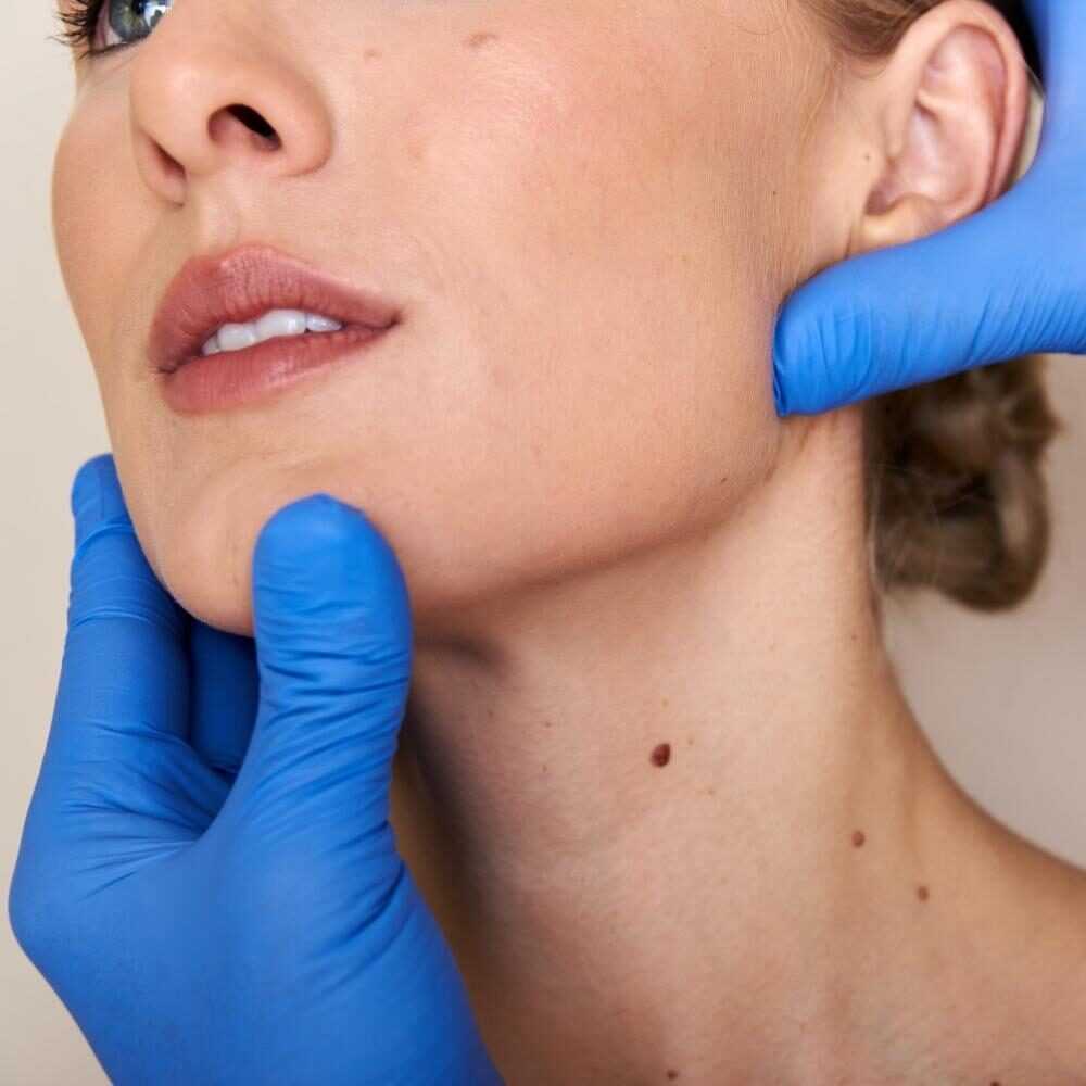 Neck/Chin Vaser Lipo